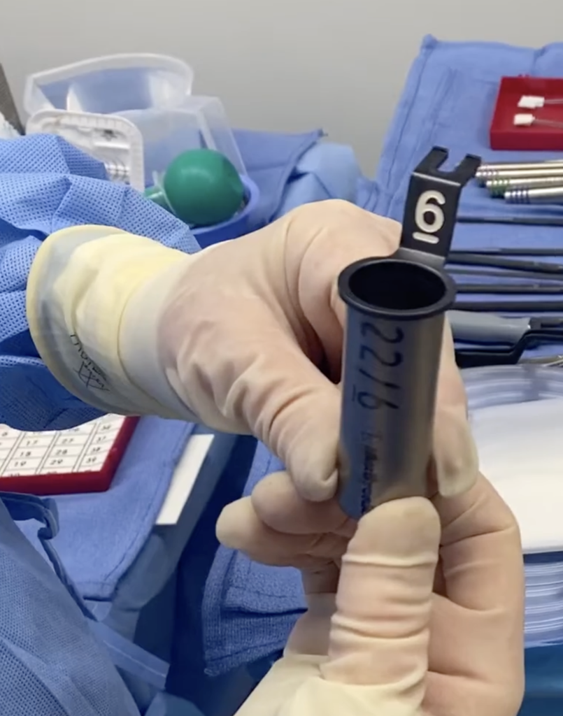Écarteur tubulaire (tube de rétraction) du système MetrX de Medtronic tenu en main